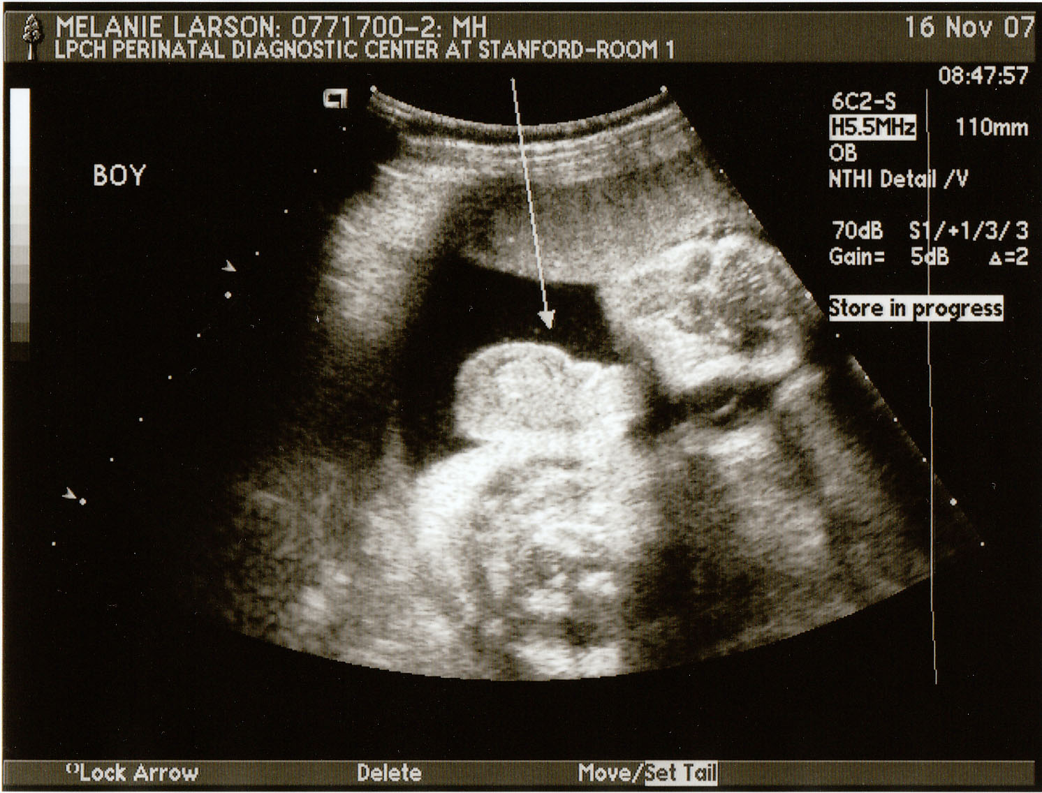 Ultrasound Boy