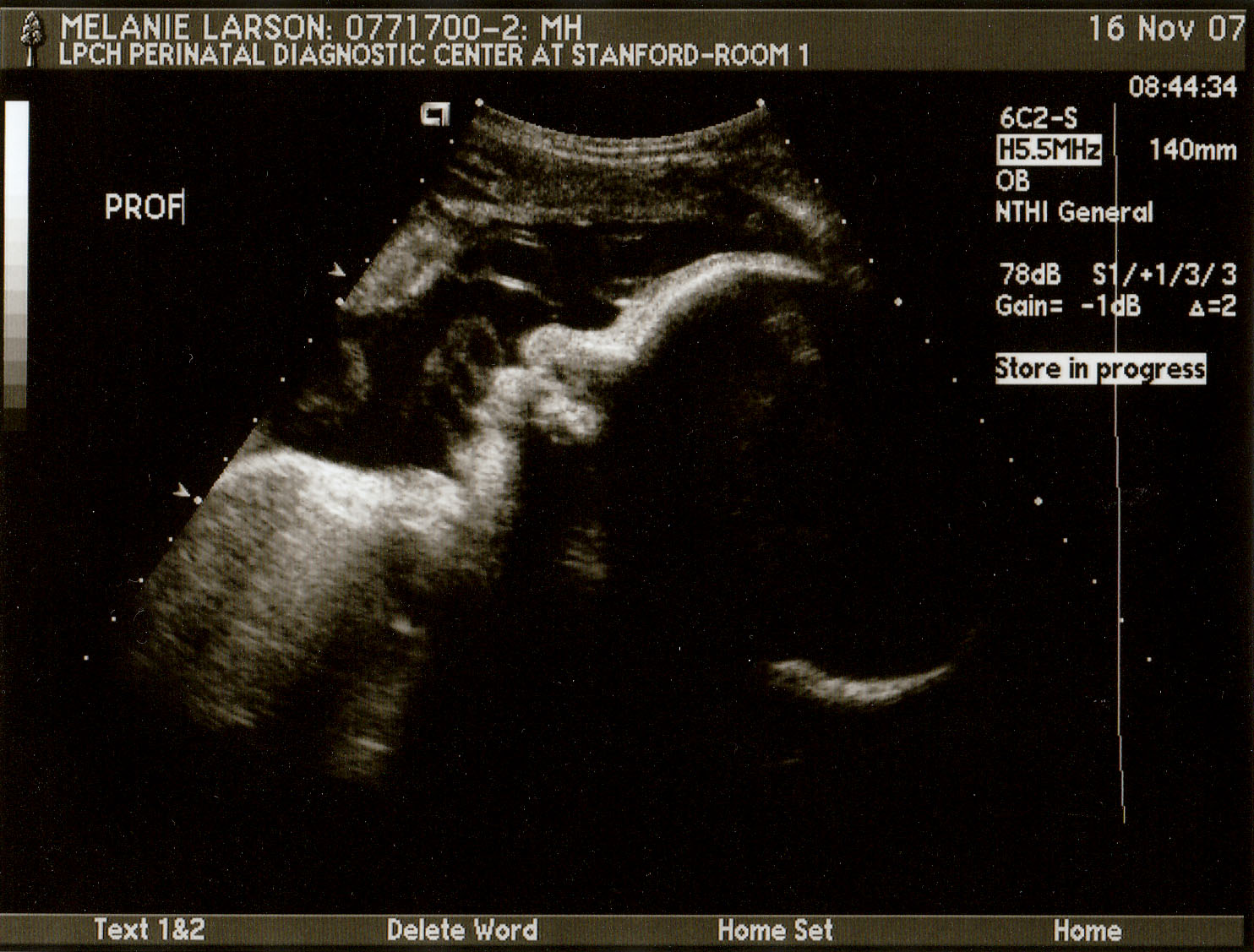 Ultrasound Profile Pictures